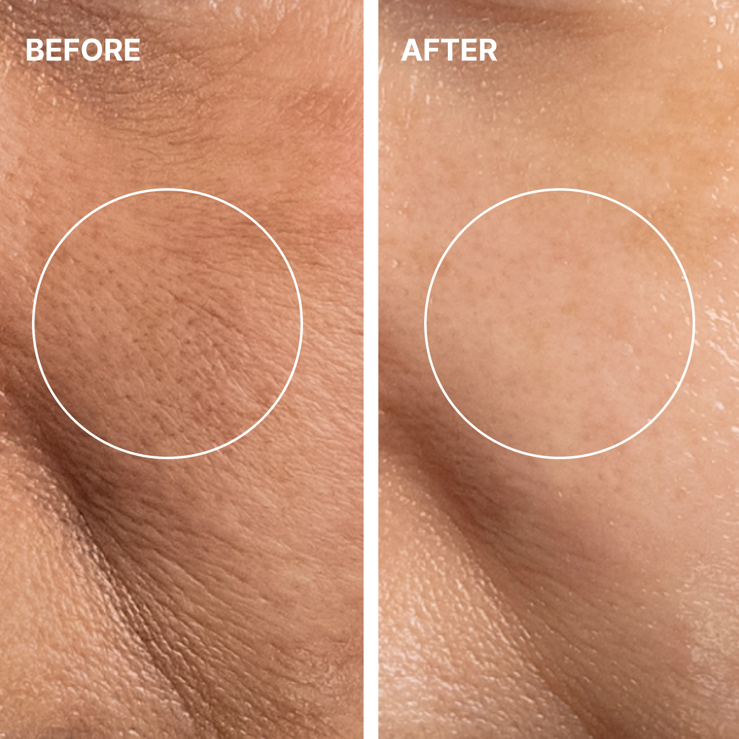 THOME G-Peel 4-Step Facial Kit | Smooth, Hydrated & Radiant Skin (12sheets)