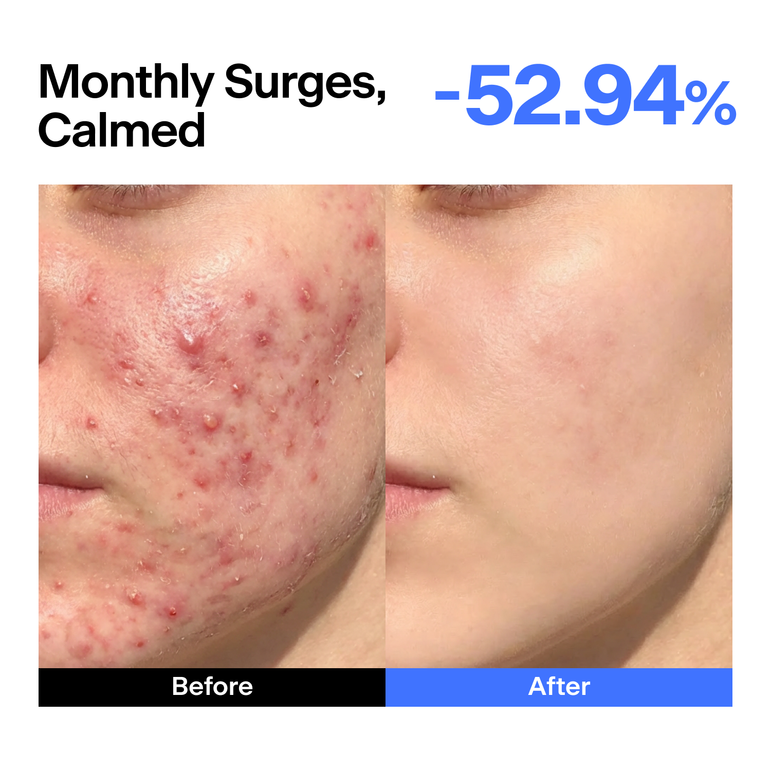 ABC Triple Synergy Redness Comfort Serum