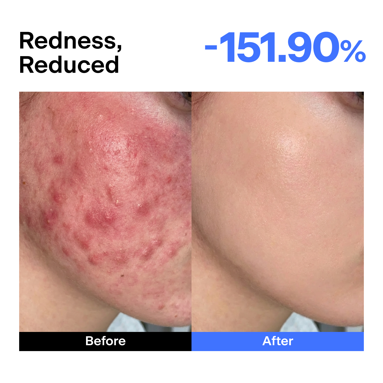 ABC Triple Synergy Redness Comfort Serum